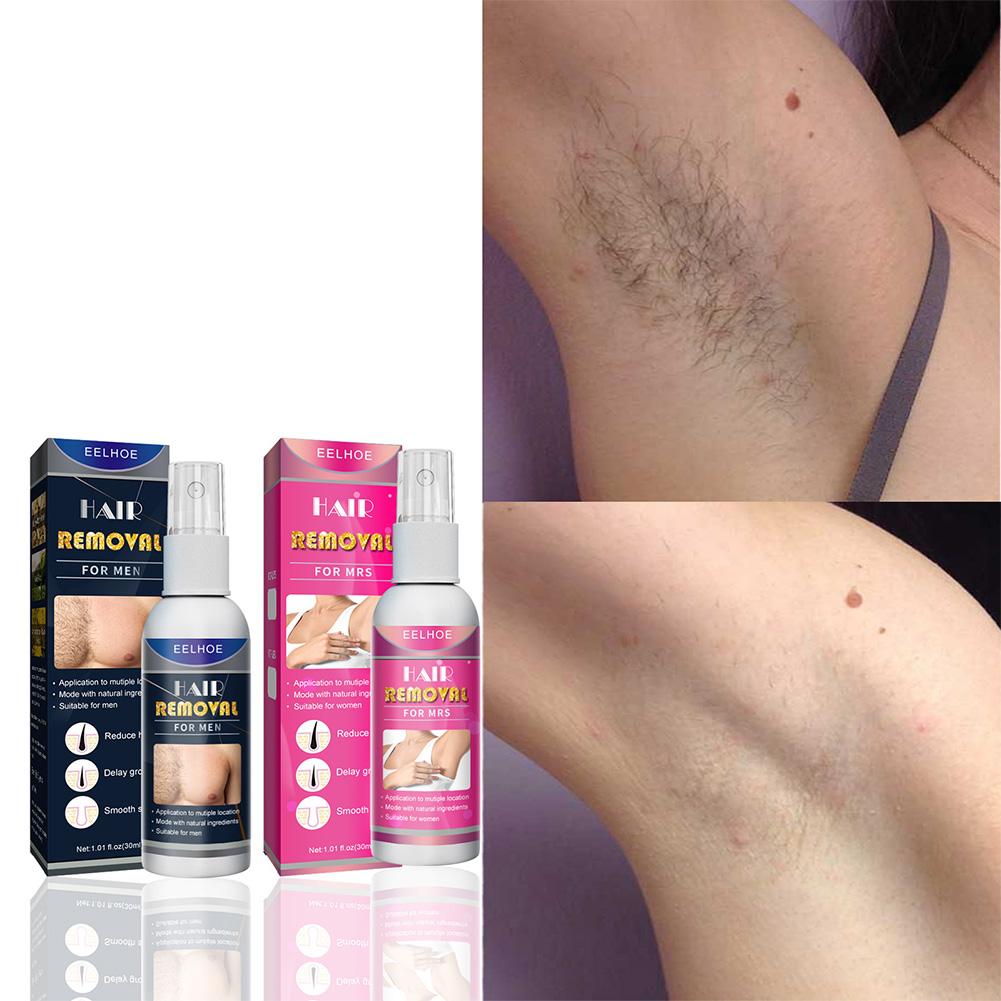 1/2PCS Super Natürliche Schmer – Body Lotion Bewertung und Preis